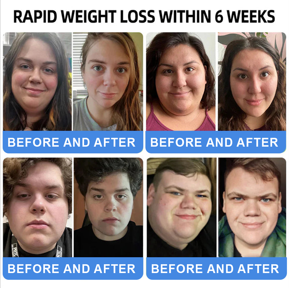 【Last Day Promotion 66% OFF💰】 𝑪𝒗𝒓𝒆𝒐𝒛® NIDDK-Tirzepatide Oral Solution 🍀Use once every two days, | Lose 20 pounds quickly | Reduce sugar by 90% |)👨‍⚕️