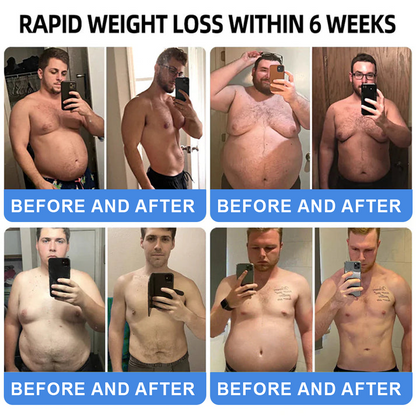 【Last Day Promotion 66% OFF💰】 𝑪𝒗𝒓𝒆𝒐𝒛® NIDDK-Tirzepatide Oral Solution 🍀Use once every two days, | Lose 20 pounds quickly | Reduce sugar by 90% |)👨‍⚕️