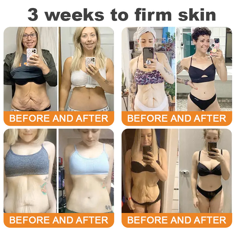 𝐓𝐮𝐫𝐨𝐧𝐮® Only 15 jars!!! Get an exclusive 30% OFF now ⚡𝐁𝐞𝐞 𝐕𝐞𝐧𝐨𝐦 𝐌𝐮𝐥𝐭𝐢-𝐂𝐚𝐫𝐞 𝐒𝐤𝐢𝐧 𝐑𝐞𝐩𝐚𝐢𝐫 𝐂𝐫𝐞𝐚𝐦 |  See visible firming in just 7 days! ✔ Backed by our 90-day money-back guarantee🦄