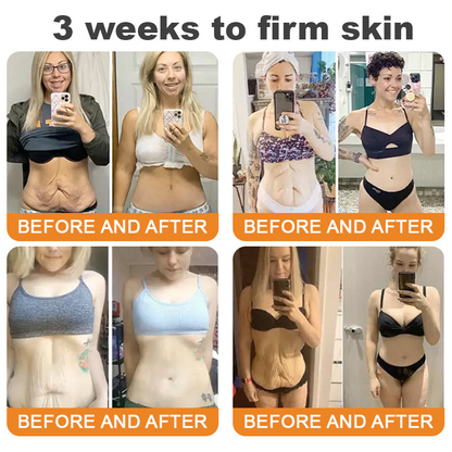 𝐓𝐮𝐫𝐨𝐧𝐮® Only 15 jars!!! Get an exclusive 30% OFF now ⚡𝐁𝐞𝐞 𝐕𝐞𝐧𝐨𝐦 𝐌𝐮𝐥𝐭𝐢-𝐂𝐚𝐫𝐞 𝐒𝐤𝐢𝐧 𝐑𝐞𝐩𝐚𝐢𝐫 𝐂𝐫𝐞𝐚𝐦 |  See visible firming in just 7 days! ✔ Backed by our 90-day money-back guarantee🦄