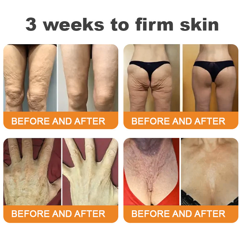 𝐓𝐮𝐫𝐨𝐧𝐮® Only 15 jars!!! Get an exclusive 30% OFF now ⚡𝐁𝐞𝐞 𝐕𝐞𝐧𝐨𝐦 𝐌𝐮𝐥𝐭𝐢-𝐂𝐚𝐫𝐞 𝐒𝐤𝐢𝐧 𝐑𝐞𝐩𝐚𝐢𝐫 𝐂𝐫𝐞𝐚𝐦 |  See visible firming in just 7 days! ✔ Backed by our 90-day money-back guarantee🦄