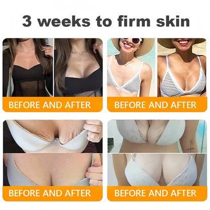 𝐓𝐮𝐫𝐨𝐧𝐮® Only 15 jars!!! Get an exclusive 30% OFF now ⚡𝐁𝐞𝐞 𝐕𝐞𝐧𝐨𝐦 𝐌𝐮𝐥𝐭𝐢-𝐂𝐚𝐫𝐞 𝐒𝐤𝐢𝐧 𝐑𝐞𝐩𝐚𝐢𝐫 𝐂𝐫𝐞𝐚𝐦 |  See visible firming in just 7 days! ✔ Backed by our 90-day money-back guarantee🦄